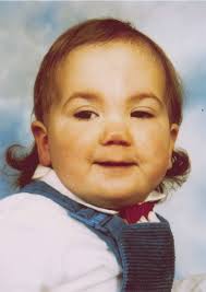 Ophthalmic Findings in Fetal Anticonvulsant Syndrome(s)