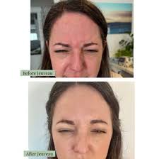 TOP 10 BEST Weight Loss Centers near Laguna Beach, CA