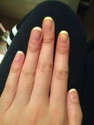Unlike acrylic nails, gel nails only harden when exposed to uv light. Why Acrylics Turn Yellow Prevent Yellowing Acrylic Nails