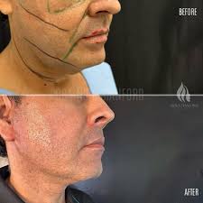 𝐃𝐑 𝐍𝐎𝐑𝐀 𝐒𝐓𝐀𝐍𝐅𝐎𝐑𝐃 𝐏𝐥𝐚𝐬𝐭𝐢𝐜 S𝐮𝐫𝐠𝐞𝐨𝐧