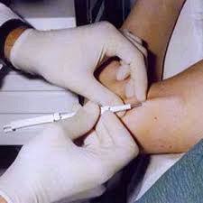 Image result for Implanon