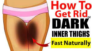 How To Lighten Your Dark Inner Thighs Naturally Dark Spots On Skin Lighten Inner Thighs Dark Underarms