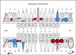 dental charting symbols dental charting symbols australia