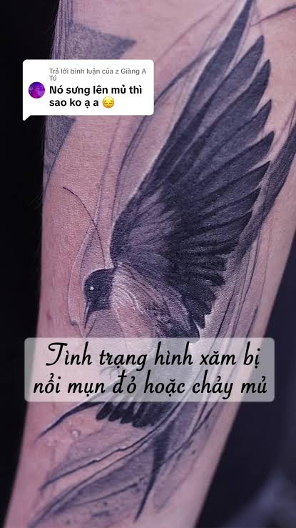 Hình xăm mới bị đỏ và kích ứng da nhẹ sau khi xăm trong giai đoạn đầu