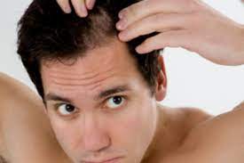 While average drinkers can hold on to their hair, habitual consumers are at high risk. Expert Advice For Men Suffering From Hair Loss Ultimate Hair Nashville