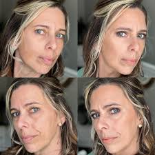 What could be causing redness