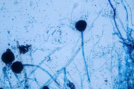 Image result for Asparagus aspergillus