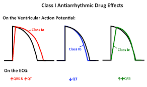 Intro_to_antiarrhythmics Tusom Pharmwiki