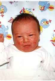 When the doctor discovered the baby was breach, what was the solution?