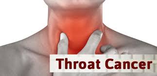 How does the doctor know i have oral cavity and oropharyngea l cancer? Symptoms Of Throat Cancer Eposts Newspaper Find And Browse Through Varies Useful Information