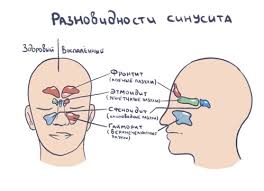Особенности терапии