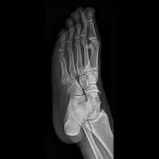 The solution consists of a tablet* and choice of a wireless cxdi digital radiography (dr) system, which includes cxdi control software ne. Cxdi 710c Cxdi 810c And Cxdi 410c Wireless Digital Radiography Systems Clinical Gallery Canon Medical Systems Usa