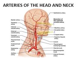 In the past, test for this condition was not that advanced as it is today. Head And Neck Arteries Quiz