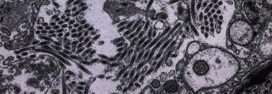 The rage virus, also known simply as (the) infection, is a fictional disease in 28 days later. Crisis In The Hot Zone The New Yorker