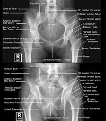 Labeled Radiographic Anatomy Differences Between Male Female Pelvis The Male Pelvic Inlet Is Radiology Student Human Anatomy And Physiology Medical Anatomy
