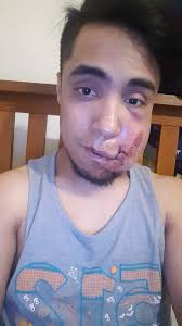 Player injured during softball game