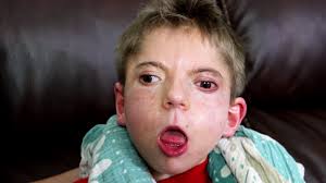 Anthony's Desire to Connect