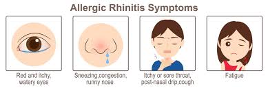 Image result for Allergic Rhinitis