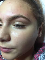 Hidden Fox Aesthetics