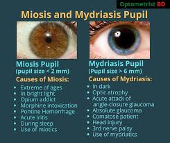 Image result for Mydriasis