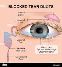 Image result for Dacryoadenitis