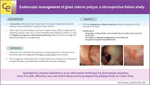 Image result for Colonic Polyp