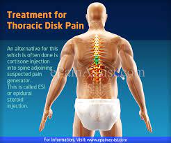 Maybe you would like to learn more about one of these? Thoracic Disk Pain Types Symptoms Treatment Epidural Steroid Injection Pt