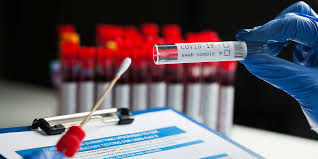 These tests play a … False Negative How Long Does It Take For Coronavirus To Become Detectable By Pcr Gavi The Vaccine Alliance
