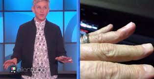 Check out the latest news and gossip on celebrities and all the big names in pop culture, tv, movies, entertainment and more. Ellen Degeneres Dislocated Her Finger While Trying To Save Her Wine Pics Metro News
