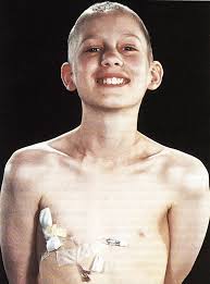 Image result for Difficult Intravenous Access in Children