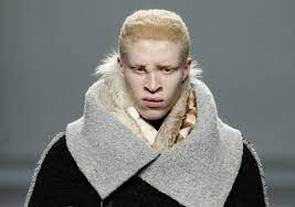 We did not find results for: Shaun Ross Model Alchetron The Free Social Encyclopedia