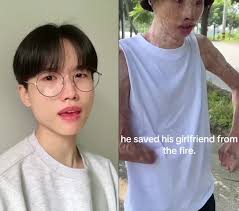 Man Saved Girl from Fire