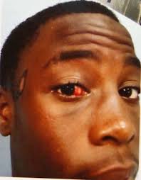 Ruling upheld in police beating of Houston teen Chad Holley