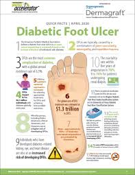 Quick Facts Diabetic Foot Ulcers 2020 In 2020 Diabetic Feet Ulcers Feet Care