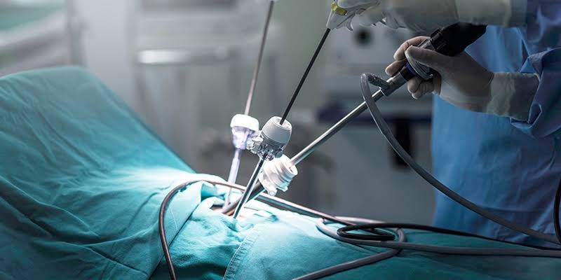 Laparoscopy surgery product image