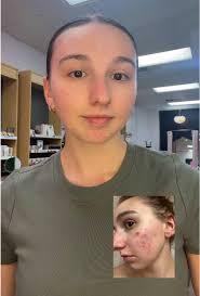 Merle Norman Review Dermatologist