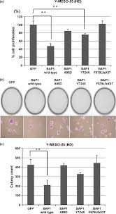 Malignant mesothelioma (mm) is a rare but highly lethal tumour derived from . Brca1 Associated Protein 1 Bap1 Suppresses Cell Proliferation Of Download Scientific Diagram