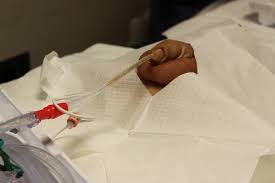 Image result for Urethral Catheterization