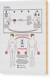 Image result for Sarcoptes scabiei life cycle