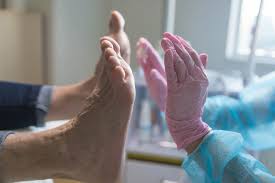 как вывести сухой мозоль со стержнем на пальце ноги Hea Jalahooldus Pedikuur Probleemsetele Ja Tervetele Jalgadele Posts Facebook