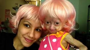 Adalia Rose And Her Family Will Make Their National Tv Debut With Anderson Cooper