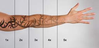 I thought you were asking how tattoos work. How Does Laser Tattoo Removal Work Laser Tattoo Removal Guide