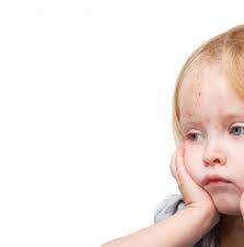 Think Outside the Box The Measles So Long, Seasonal Allergies! Hike for  Your Health Clear Up Canker Sores See you in Philly!