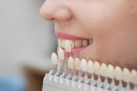 This gives you the opportunity to talk with our dentists about a dental implant and to ask any questions you may have. Affordable Teeth Fillings Bonding In Melbourne Boxhill Free Consultation