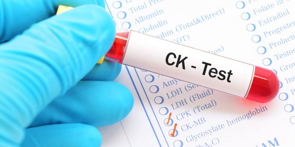 CK MB product image