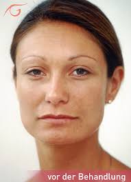 Natürlichkeit bewahren