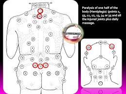Pin By Dr Nafisa On Hijamah Hijama Hijama Points Cupping Points