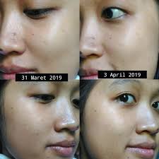 REVIEW : Laneige Clear C Peeling Serum