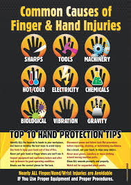 This Safety Poster Identifies The Main Hand Hazards Workers Need To Identify And Lists Health And Safety Poster Safety Posters Occupational Health And Safety