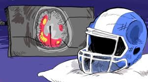 Head injury in sports statistics found that the head is involved in more baseball injuries than any other body part. Head Injuries American Football Ethics Unwrapped